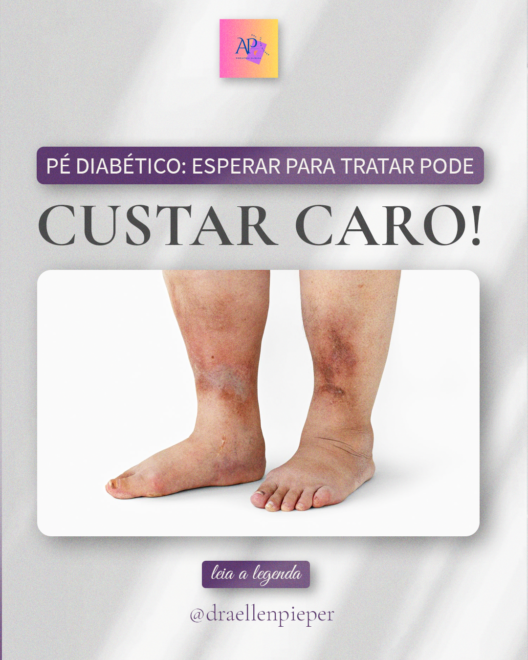 Projeto AP - Podiatria Clínica